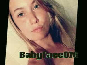 Babyface076